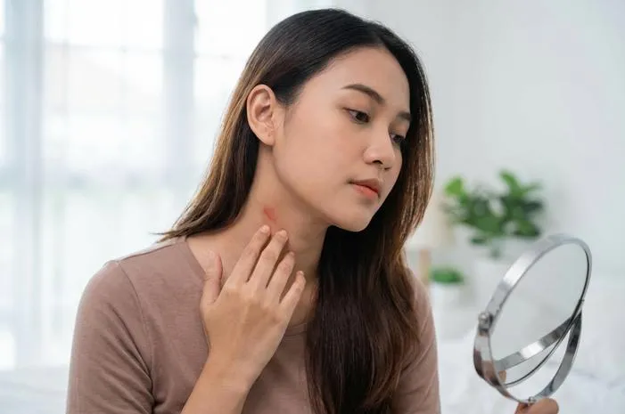 Cupang: Si Ikan Cantik atau Tanda di Leher?