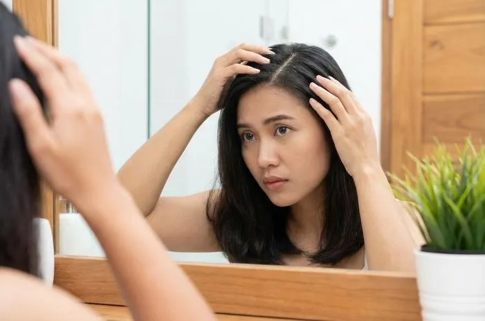 Kenali Jenis Ketombe Biar Gak Salah Pilih Sampo