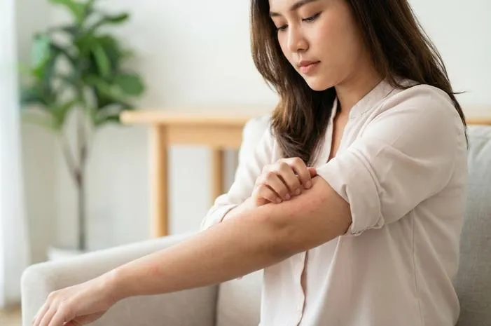 Gatal Ruam Merah? Ini Penyebab dan Solusi Praktisnya