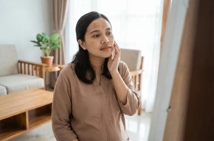 Cloasma Gravidarum: Ini Flek Wajah Wajar Ibu Hamil