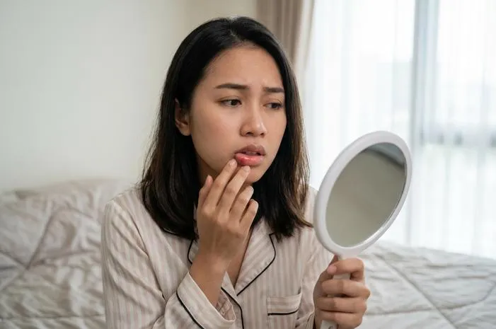 Bibir Bengkak Saat Bangun Tidur? Jangan Panik, Ini Solusinya