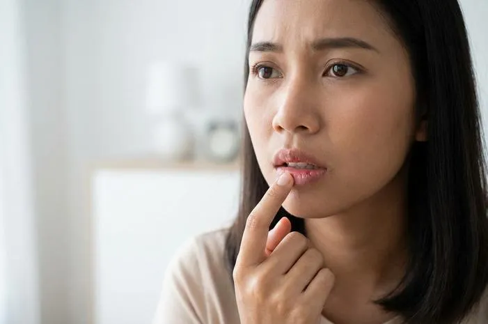 Bibir Luka Mengganggu? Ini Tips Mudah Mengatasinya