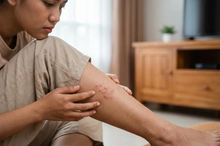 Atasi Jerawat di Kaki: Kulit Mulus Kembali!