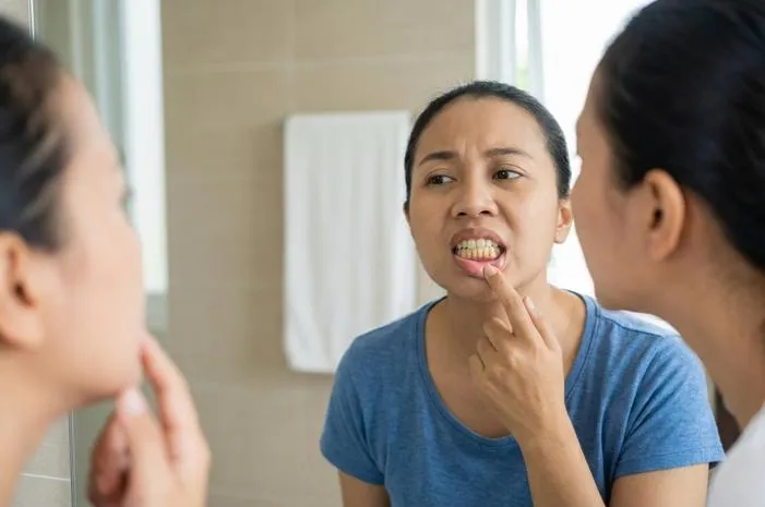 Karang Gigi Kuning Minggat! Senyum Bersih Anti Bau