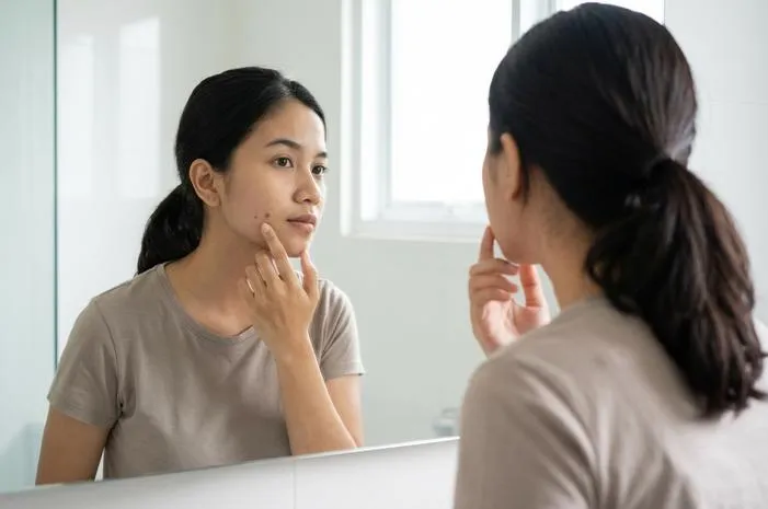 Jerawat di Pipi Artinya? Terkuak Fakta di Baliknya!