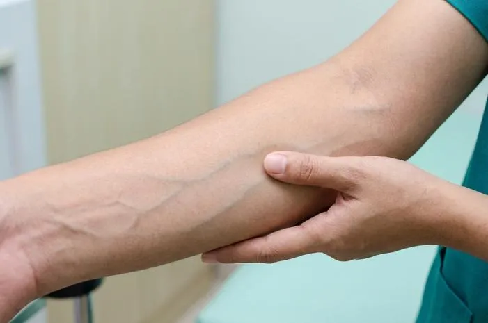 5 Ciri Pembuluh Vena: Bedanya dengan Arteri
