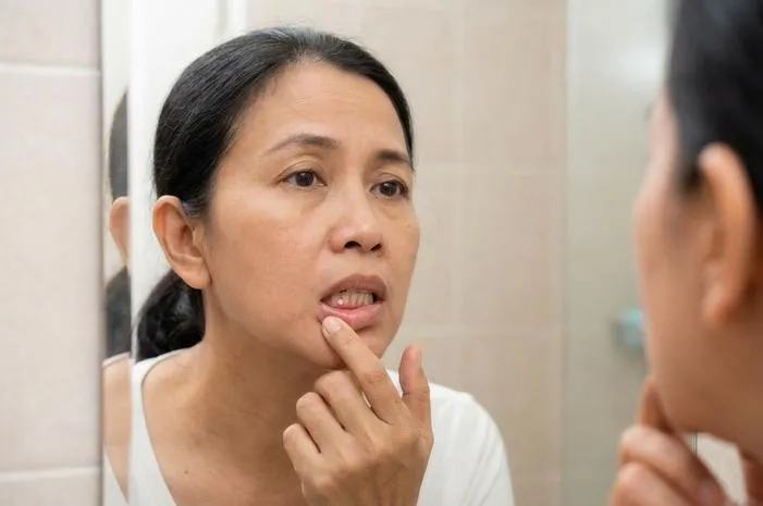 Benjolan Putih di Gusi: Normal atau Perlu ke Dokter?