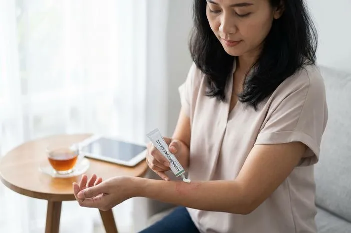 Obat Hydrocortisone Acetate: Untuk Gatal dan Radang Kulit