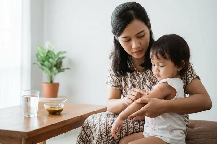 Tampek dan Campak: Sama, Hanya Beda Sebutan Lokal