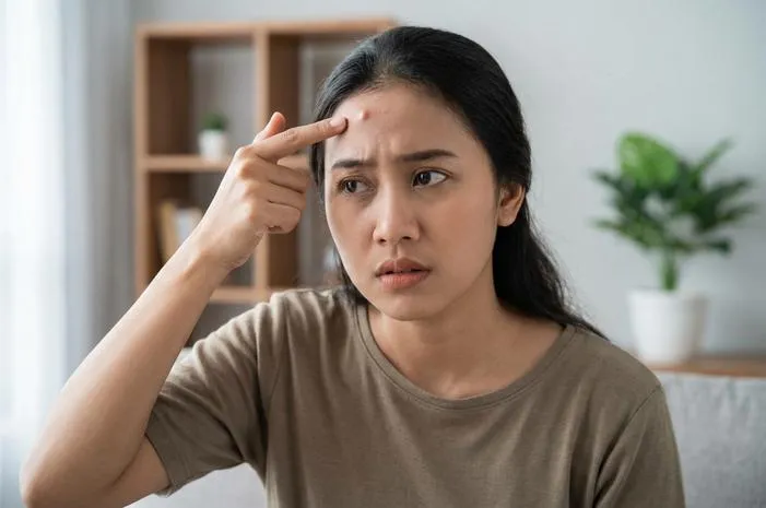 Benjolan di Dahi Keras Seperti Tulang, Ini Kata Dokter