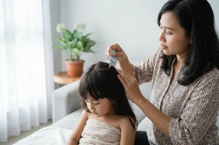 Cara Mengatasi Kutu Rambut: Basmi Tuntas Dijamin Ampuh