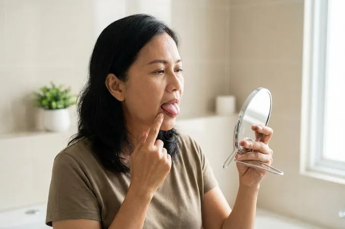 Papila Lidah Bentol? Kenali Penyebab dan Solusinya