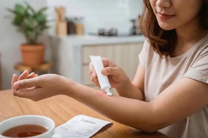 Salep Luka Bakar dan Harganya, Solusi Cepat Tanpa Repot