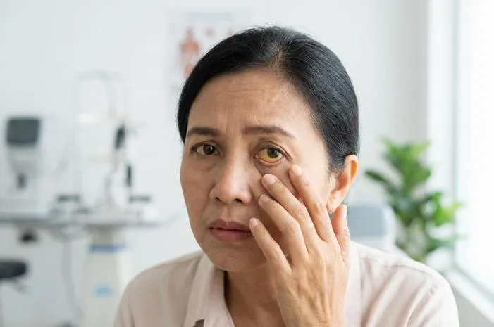 Mata Berwarna Kuning: Kenali 5 Penyebab Utamanya