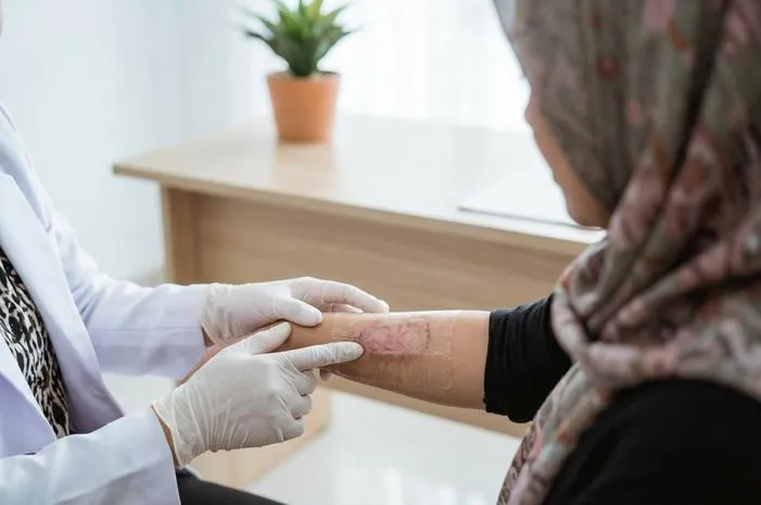 Cangkok Kulit Skin Graft: Ganti Rusak Jadi Sehat