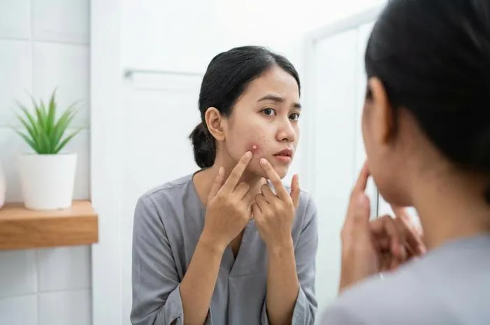 Jerawat Besar di Pipi? Ini Solusi Cepat Hilangkannya!