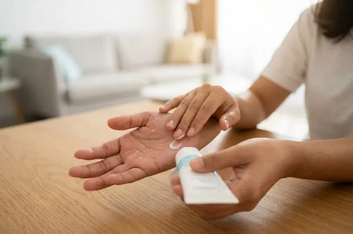 Gampang! Atasi Telapak Tangan Mengelupas Tanpa Ribet