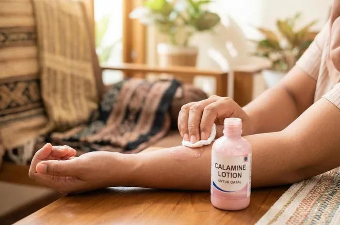 Lotion Calamine untuk Gatal: Redakan Gatal, Dinginkan Kulit