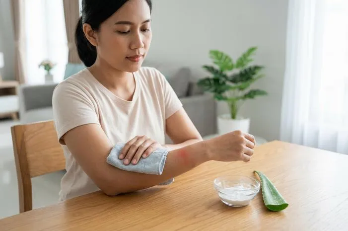 Cara Mengobati Sengatan Tawon Vespa: Langsung Reda!