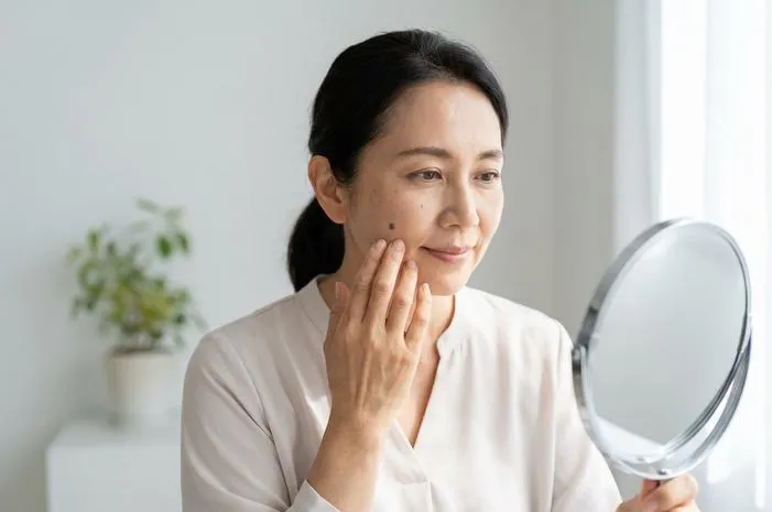 Pahami Dark Spot: Penyebab dan Solusi Kulit Cerahmu