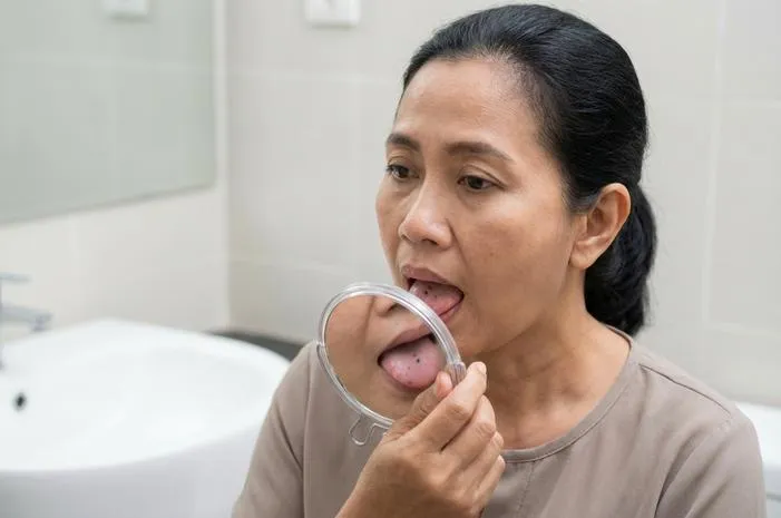 Kenapa Ada Bintik Hitam di Lidah? Cek Fakta Ini!