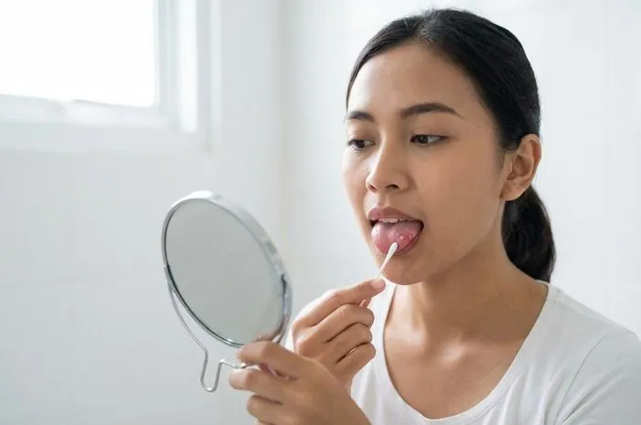 Ketahui Penyebab Bintik di Lidah Serta Solusi Mudah Atasinya