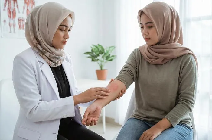 Selulitis: Gejala, Penyebab, dan Pengobatan Lengkap