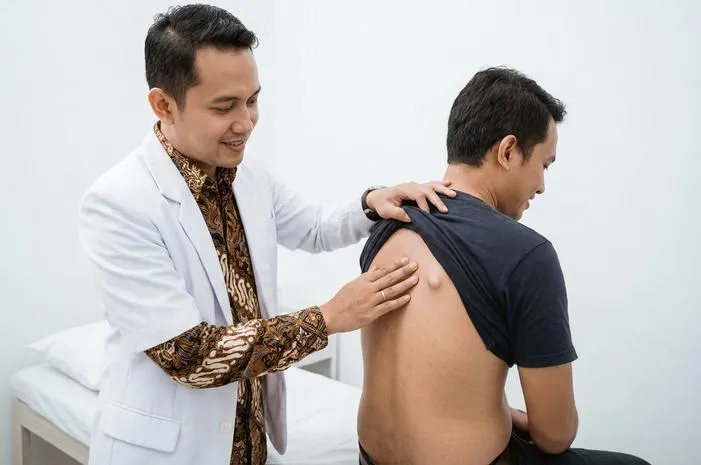 Lihat Gambar Lipoma di Punggung dan Kenali Ciri Fisiknya