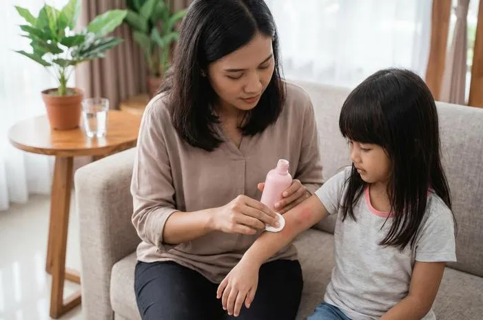 Kalamin Solusi Praktis Redakan Gatal dan Iritasi Kulit