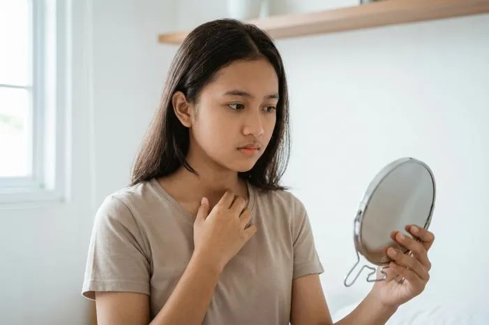 Kenapa Di Puting Ada Putih Putih Pada Remaja? Ternyata Wajar