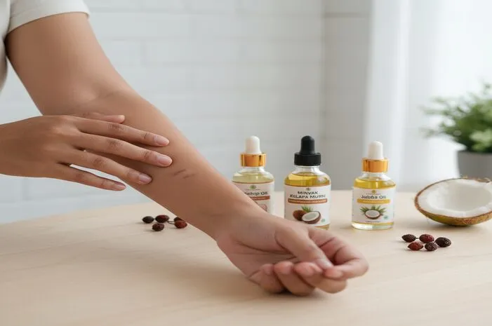 Minyak Jitu Hilangkan Bekas Luka? Wajib Coba Ini!