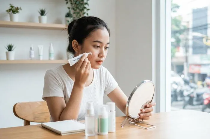Jerawat Minggat! Ini Obat Paling Ampuh di Apotek