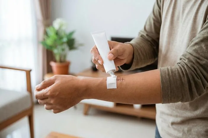 Salep Mebo Bisa Untuk Jahitan? Cek Fakta dan Aturan Aman