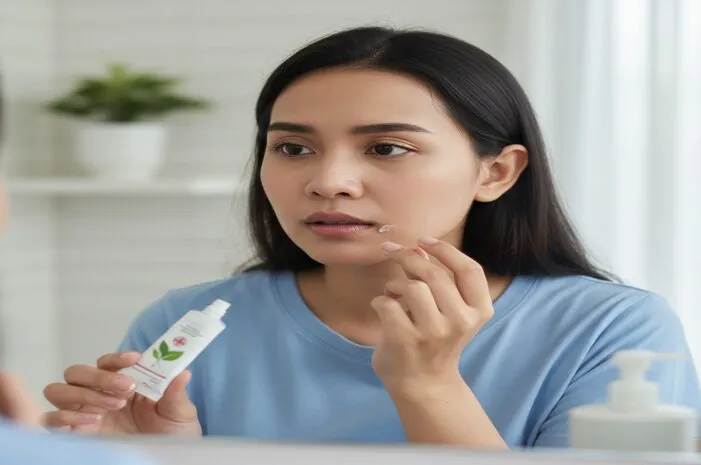 Herpes Bibir Pakai Salep Apa? Acyclovir Jawabannya!