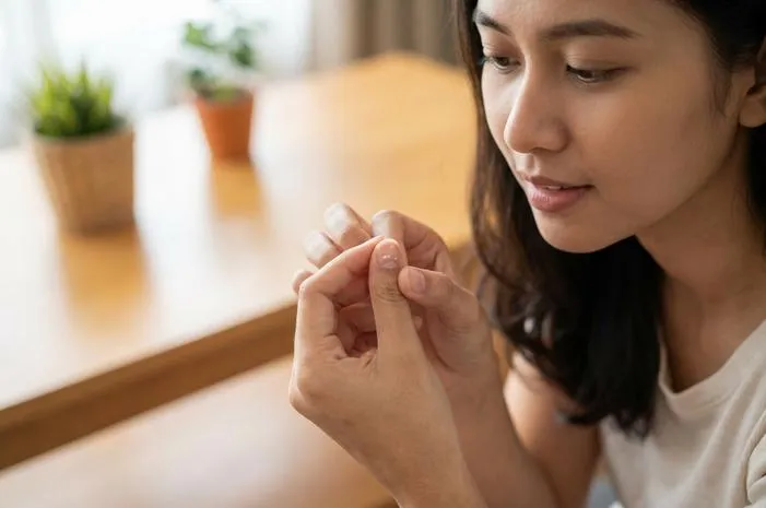 Bintik Putih Kuku Ada Naksir? Yuk, Jaga Kuku Tetap Sehat