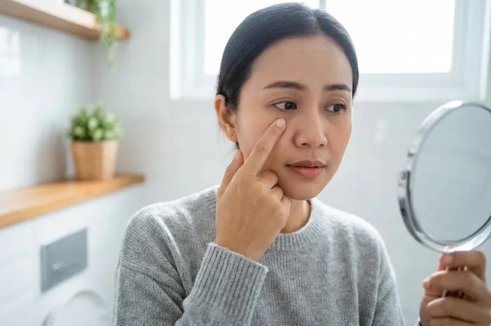 Penyebab Bintik di Bawah Mata dan Cara Ampuh Mengatasinya