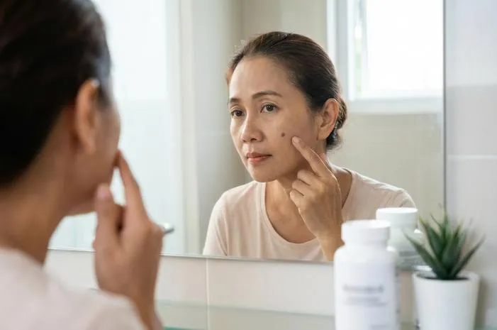 Nutrafor White Beauty: Flek Hitam Hilang Atau Samar?