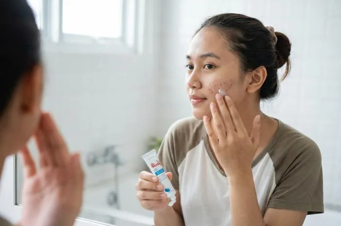 Verile Ampuh Atasi Bekas Jerawat? Ini Review Jujurnya