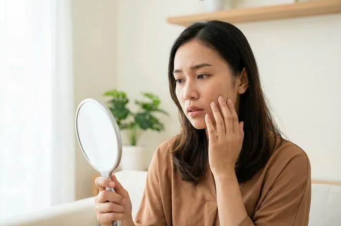 Efek KB Suntik 1 Bulan pada Wajah: Flek dan Jerawat?