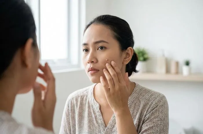 Penyebab Kutil di Wajah: Infeksi HPV hingga Kebiasaan