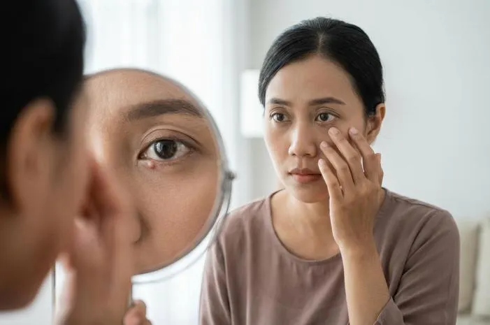 Benjolan di Dalam Mata? Kenali Penyebab dan Solusinya!