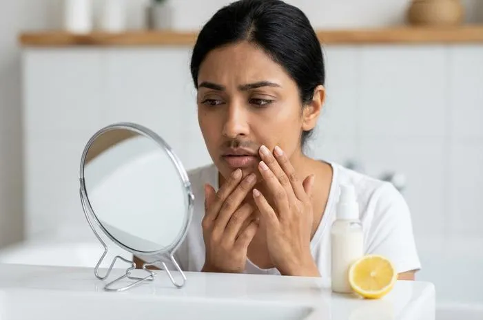 Cara Hilangkan Hitam di Samping Bibir dengan Cepat Ampuh