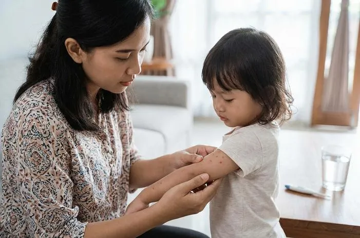 Setelah Demam Keluar Bintik Merah Pada Anak: Wajar Atau Bahaya?