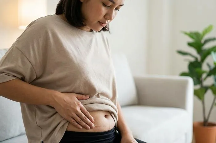 Bekas Jahitan SC Gatal? Wajar Kok, Ini Cara Atasinya!