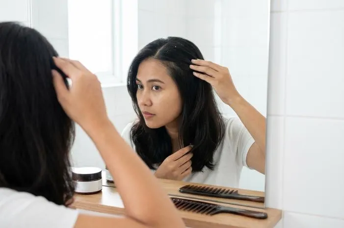 Kenali Bentuk Ketombe Kering dan Basah Serta Penyebabnya