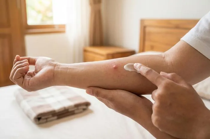 Cara Ampuh Atasi Kamitetep Gigitan Agar Cepat Sembuh