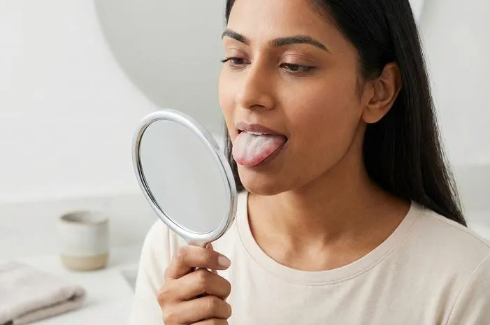 Cara Mengatasi Lidah Berjamur Putih dengan Cepat dan Tepat