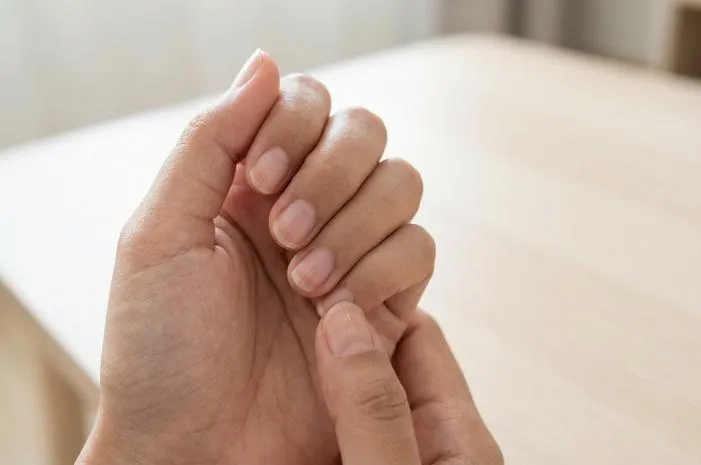 Menebak Arti Garis di Kuku: Kapan Waspada?