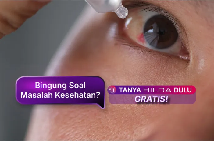 Ini Manfaat Obat Tetes Mata Insto yang Perlu Diketahui