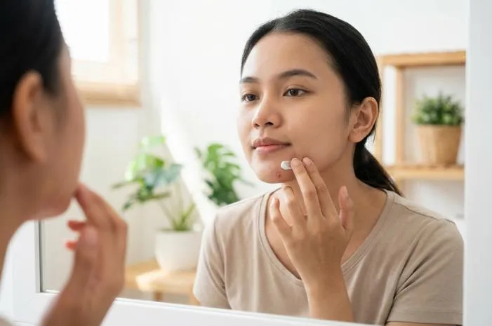 5 Rekomendasi Produk untuk Atasi Acne Prone Skin